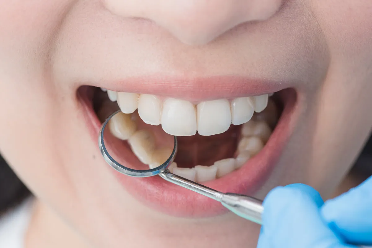 Evaluación dental gratuita en OdontoSur
